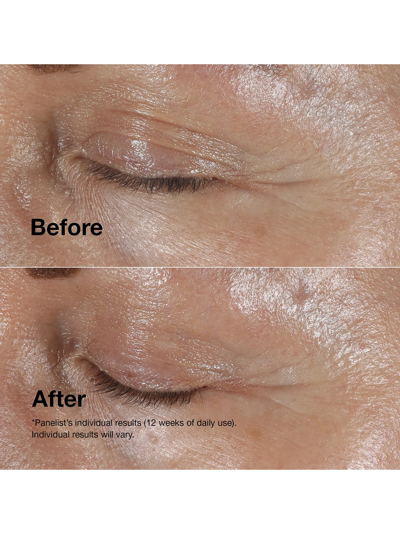 Clinique Smart Clinical Repair Anti-Aging Routine Mini Kit - Image 4