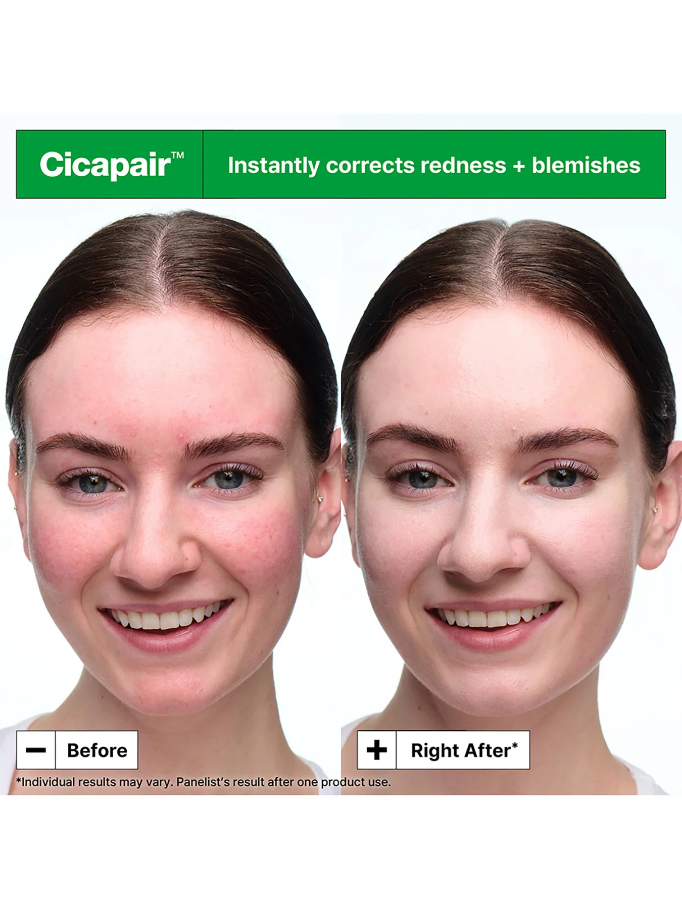The Cicapair Soothing Color Correcting Treatment SPF 30 15ml - Image 2