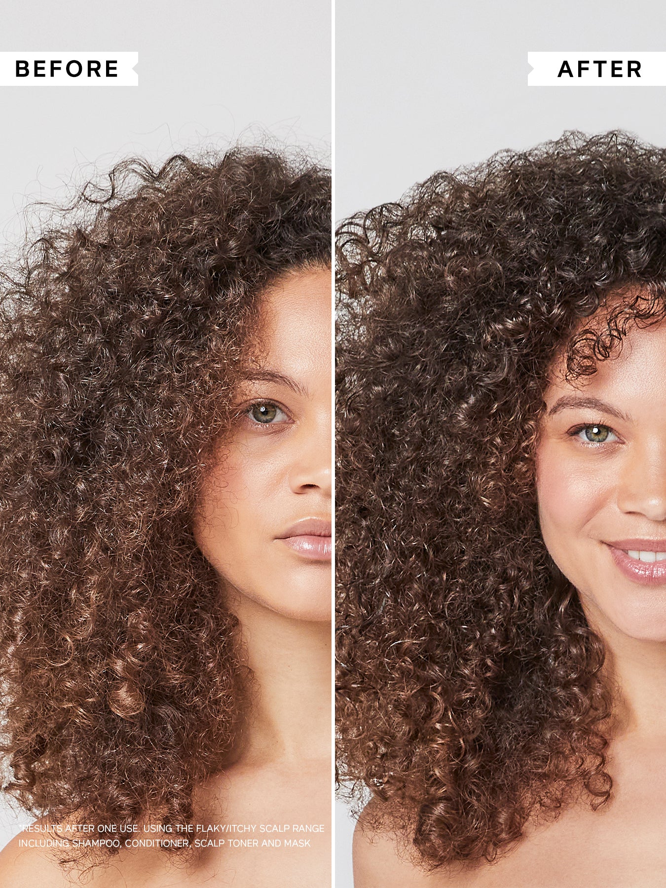 Flaky Itchy Scalp Anti-Dandruff Shampoo for Curly Hair 250ml - Image 2